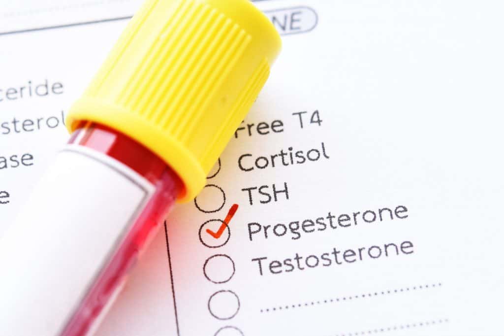 Do Men Have Progesterone